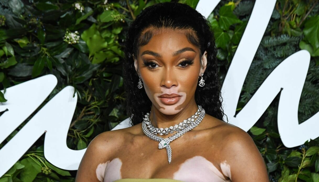 who is winnie harlow dating