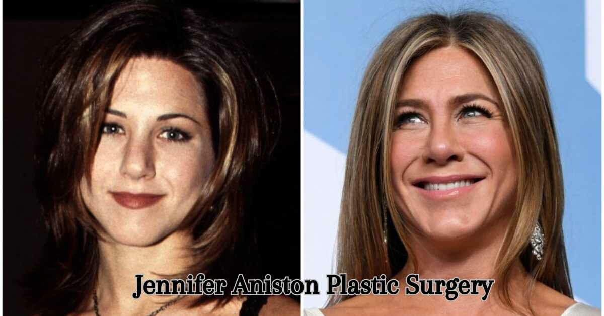 Jennifer Aniston Plastic Surgery