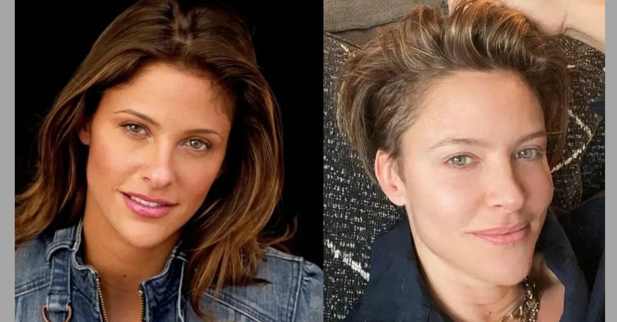 Jill Wagner Plastic Surgery