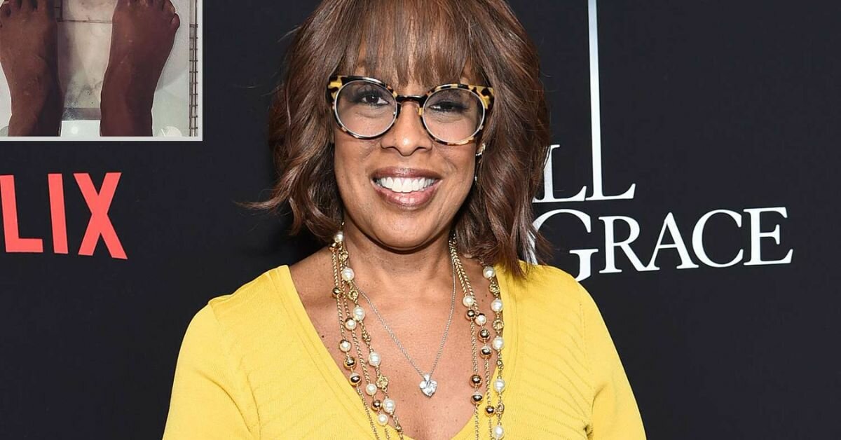 How Did Gayle King&nbsp;Lose Weight?